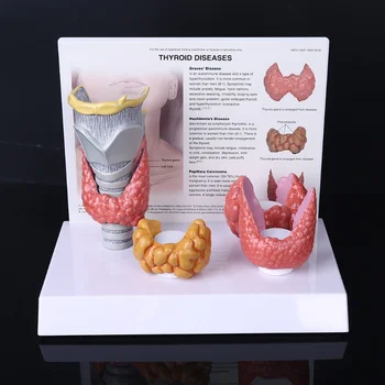Анатомическая модель Щитовидной железы Человека Патологическая Анатомия Дисплей Пищеварительной Системы Учебное Пособие